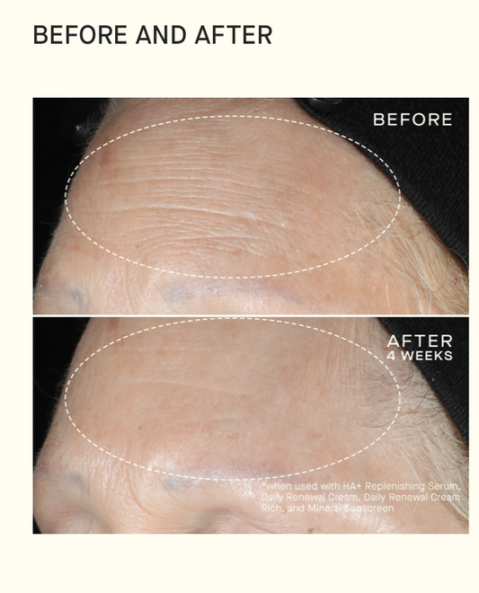 Daily Renewal Cream with Hyaluronic Acid image 1