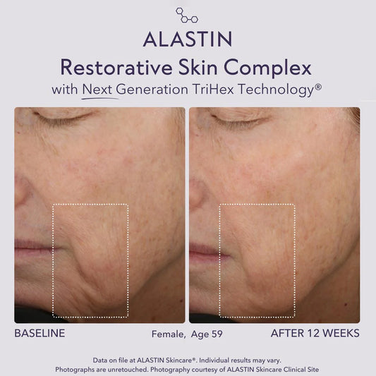Restorative SKIN Complex with TriHex+™