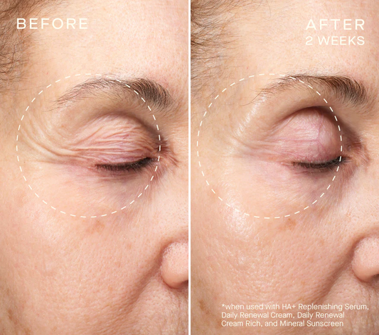 HA+ Replenishing Eye Serum image 1