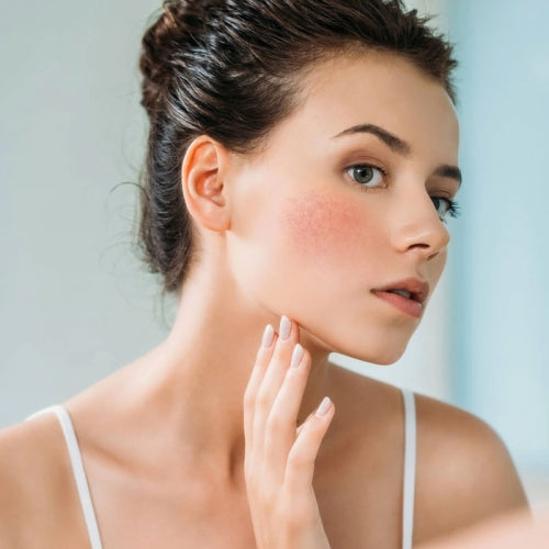 Redness