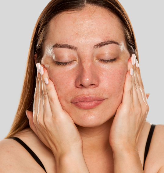 Oily Skin