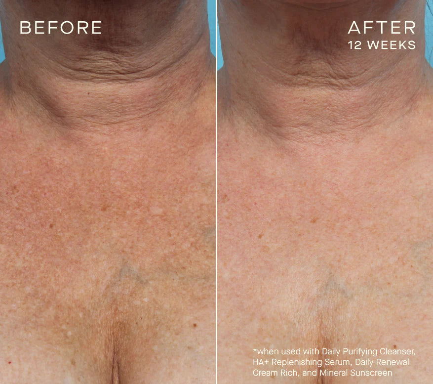 HA+ Replenishing Serum image 3