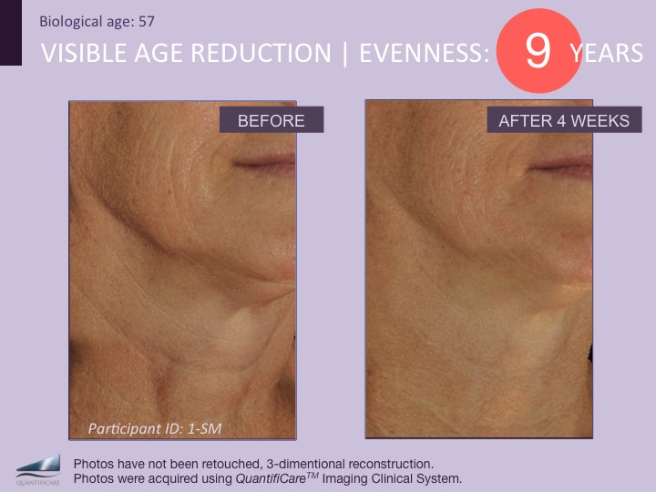 DefenAge® PRO Exclusive 6-Week Perfection Neck Cream image 1