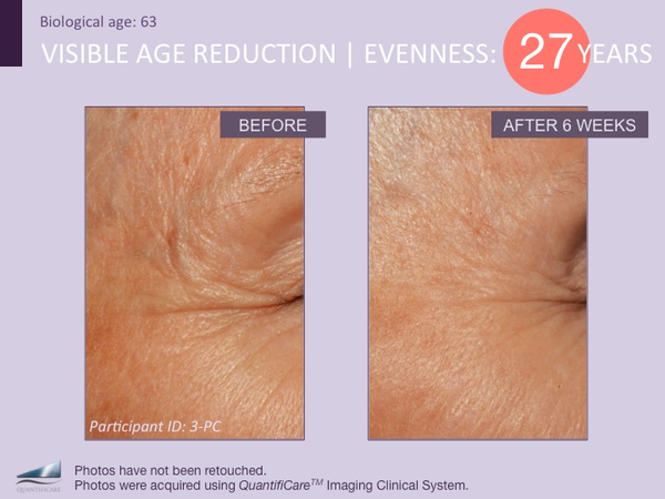 3D Eye Radiance Cream + FREE BIOSERUM (SMALL) & FREE TRAVEL BAG image 1