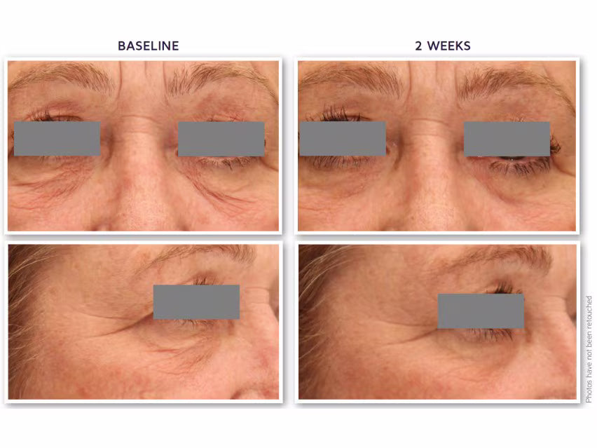 DefenAge® 3D Eye Radiance Cream