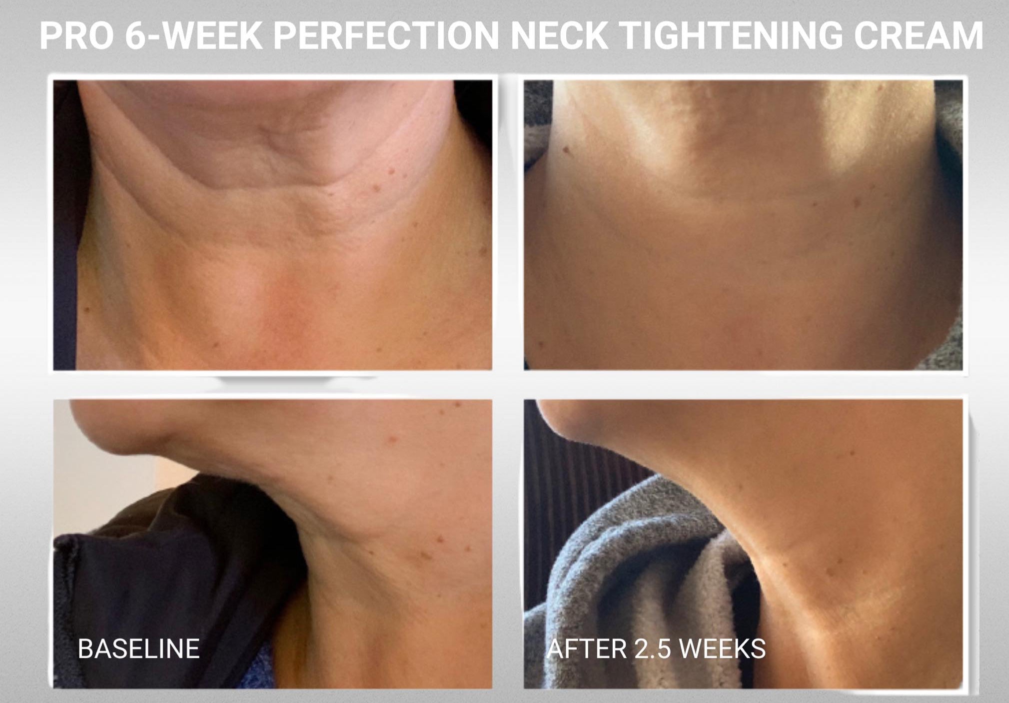 DefenAge® PRO Exclusive 6-Week Perfection Neck Cream image 2