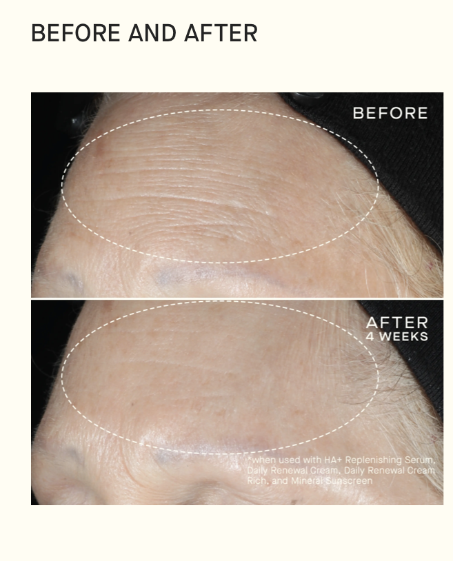 Daily Renewal Cream with Hyaluronic Acid image 1