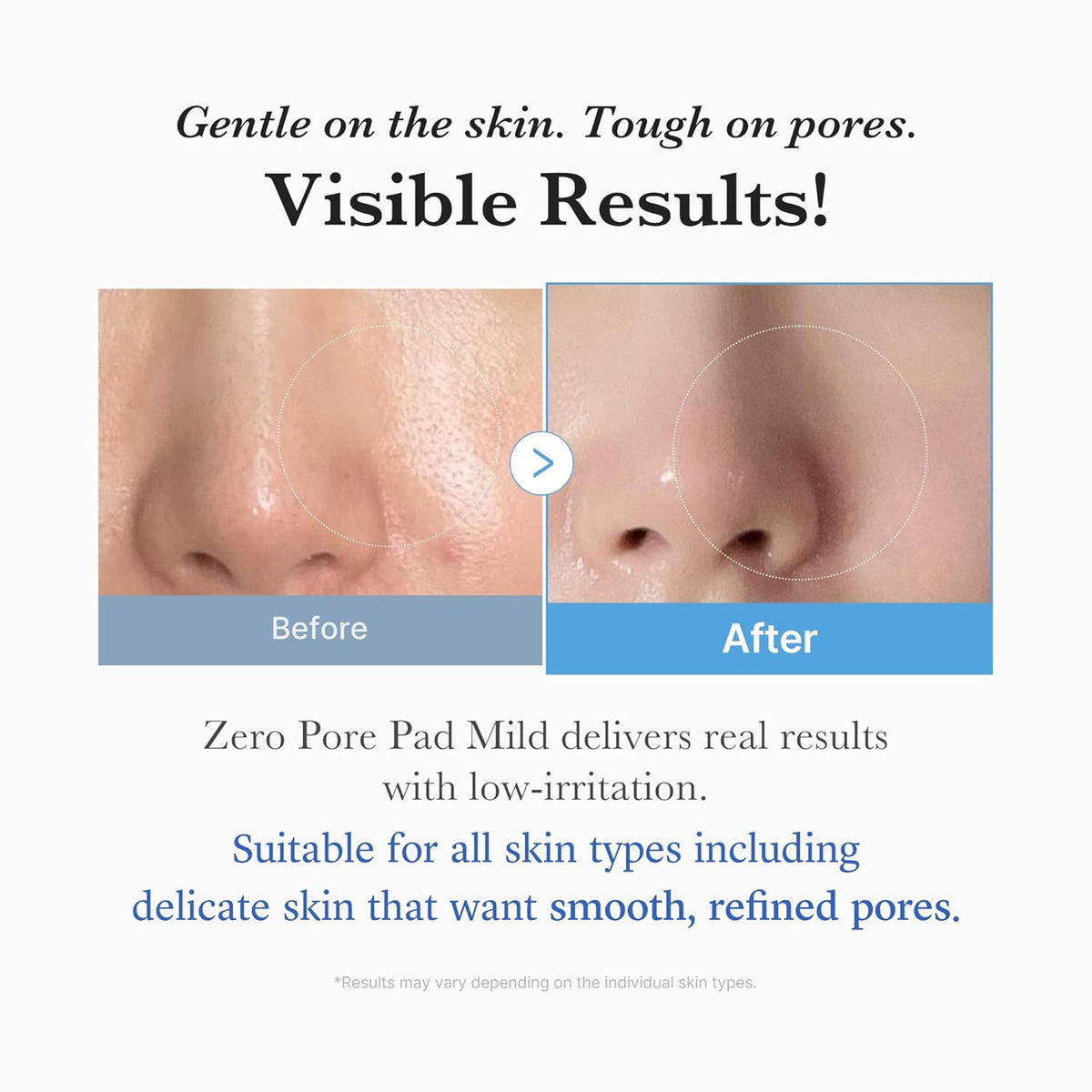 [Medicube] ZERO PORE PAD MILD (70pcs)