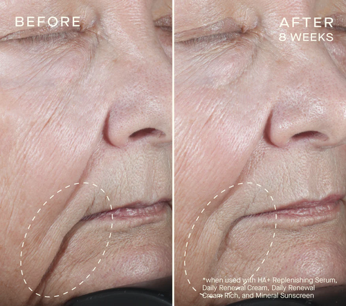 HA+ Replenishing Serum image 1