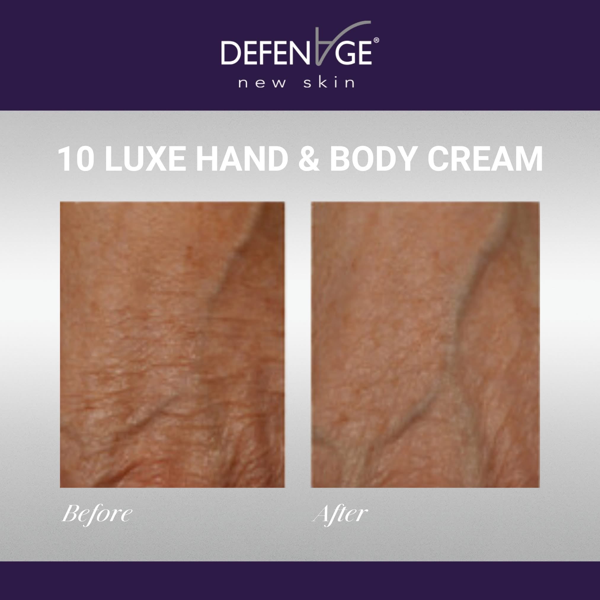 DefenAge® PRO 10 Luxe Hand & Body Cream