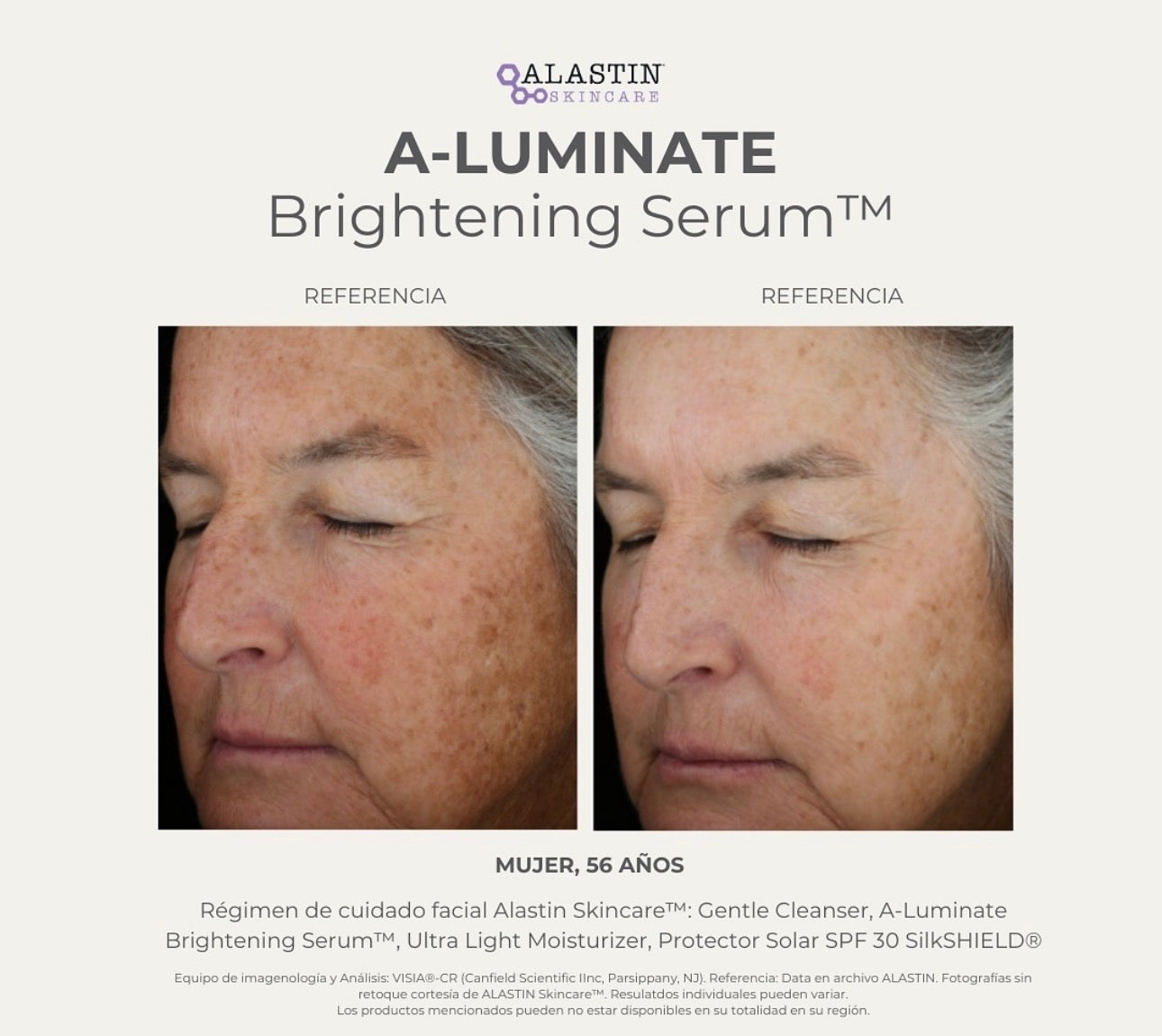 A-LUMINATE Brightening Serum™