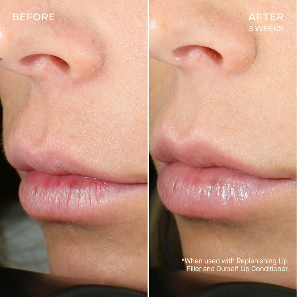 Your Best Lips Gift Set – Plump · Smooth · Define