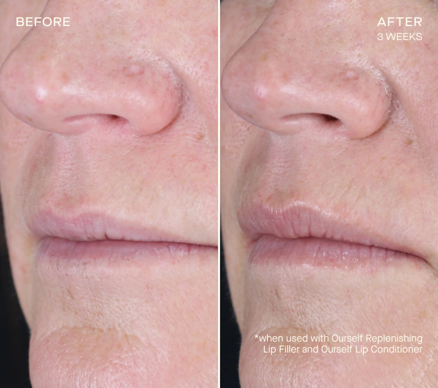 Lip Plumping & Enhancing Regimen
