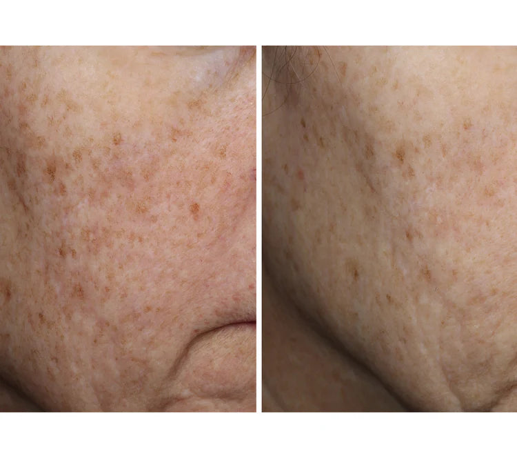 Complexion Brightening Serum