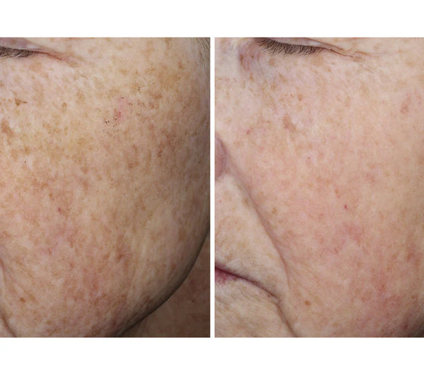 COMPLEXION BRIGHTENING SERUM