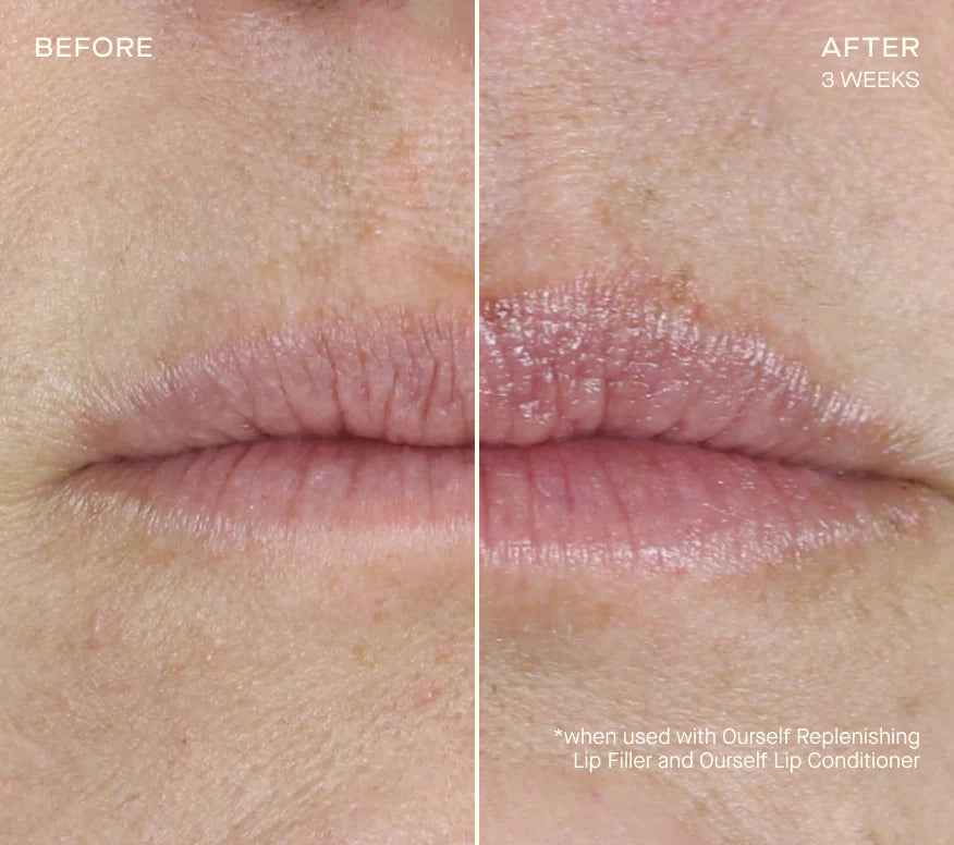Your Best Lips Gift Set (Value $230)