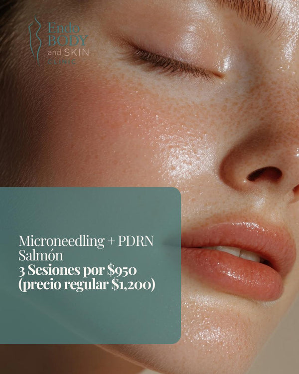✨August Offer✨ Microneedling (Face + Neck) + PDRN Salmon (ADN derivado de la esperma de salmon)