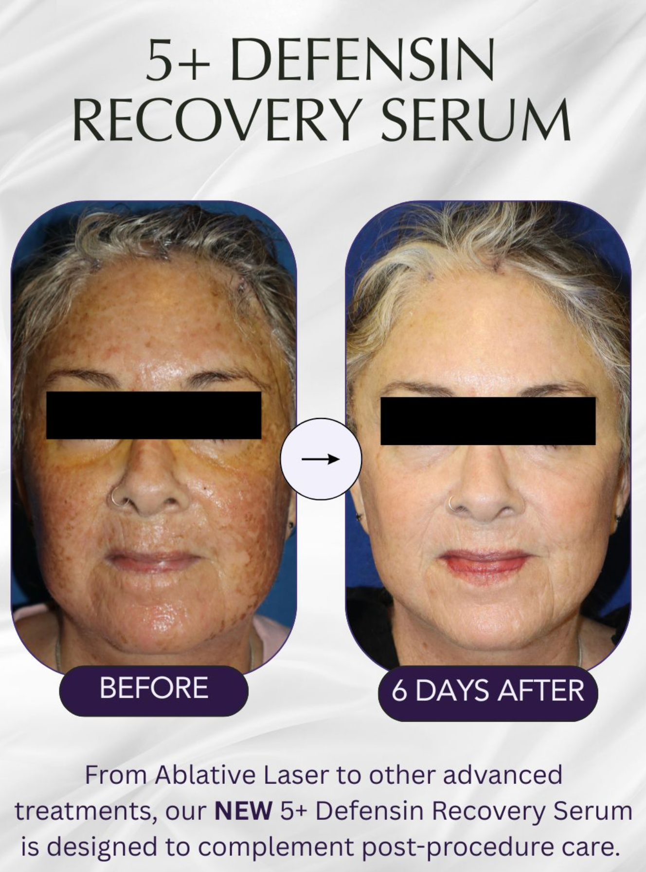 DefenAge® PRO: NEW 5+ Defensin Recovery Serum