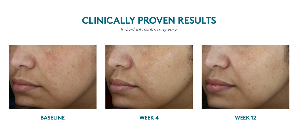 Even Up® Clinical Pigment Perfector® SPF 50(Manchas)