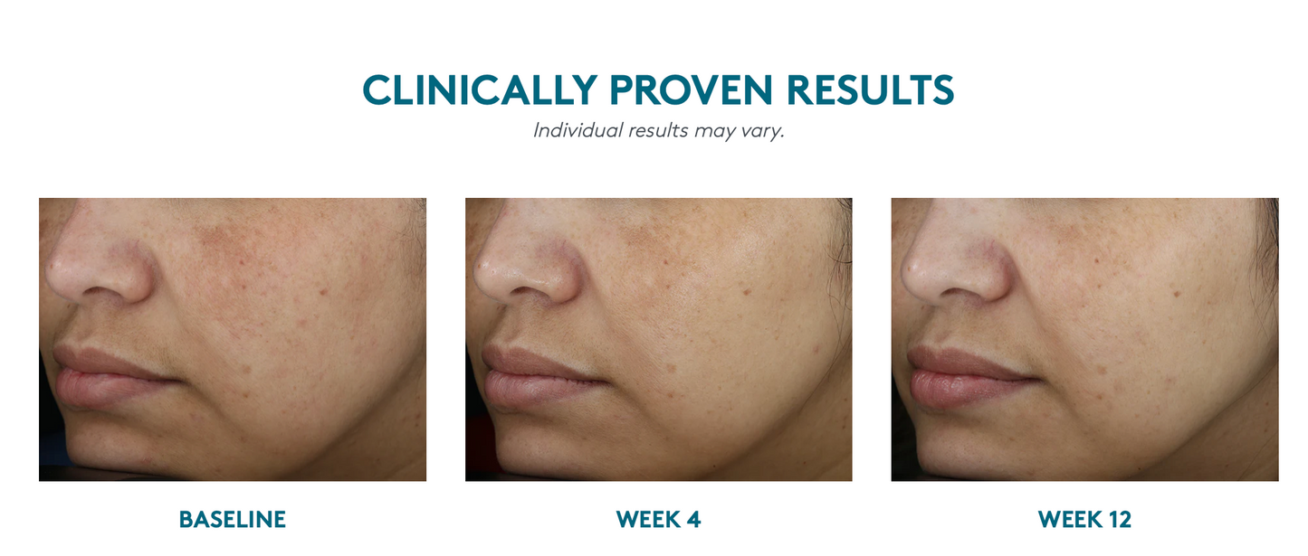 Even Up® Clinical Pigment Perfector® SPF 50(Manchas)