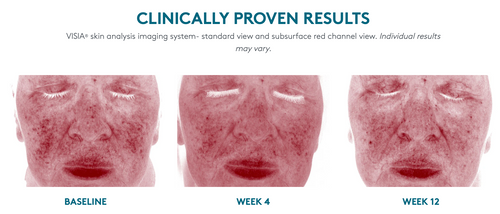 All Calm® Multi-Correction Serum (Rosacea)