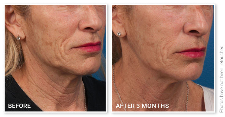 DefenAge PRO 24/7 Barrier Balance Cream & 8-in-1 Bioserum Duo