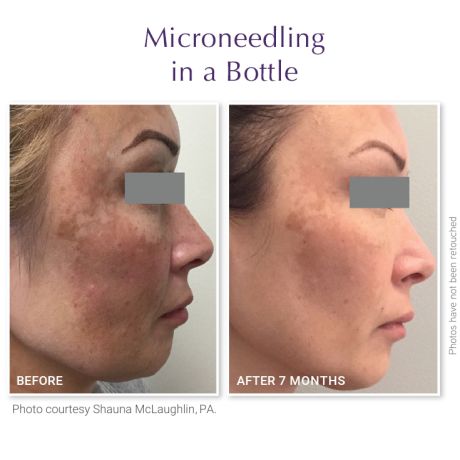 DefenAge® PRO TRAVEL KIT PLATINUM EDITION