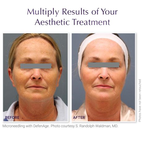 DefenAge® PRO TRAVEL KIT PLATINUM EDITION