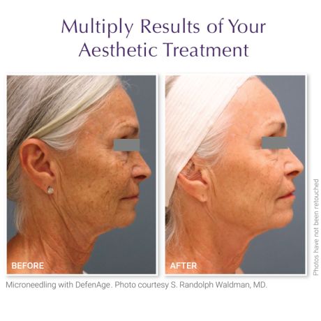 DefenAge® PRO TRAVEL KIT PLATINUM EDITION