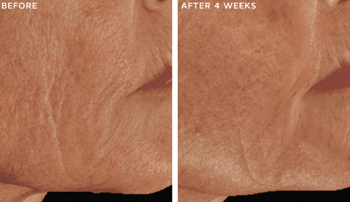 DefenAge PRO 24/7 Barrier Balance Cream & 8-in-1 Bioserum Duo