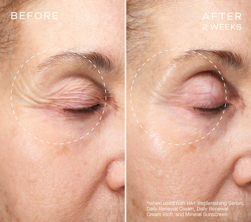 HA+ Replenishing Eye Serum image 1