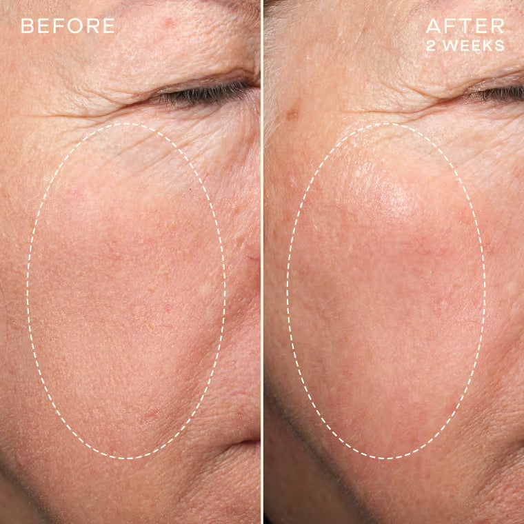 Daily Renewal Cream Rich with Intides™