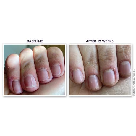 DefenAge® PRO 360-Rejuvenation Nail Root Serum