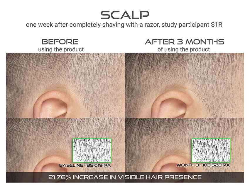 REFILL DefenAge® 150K Hair Follicle Serum (1-month-supply)