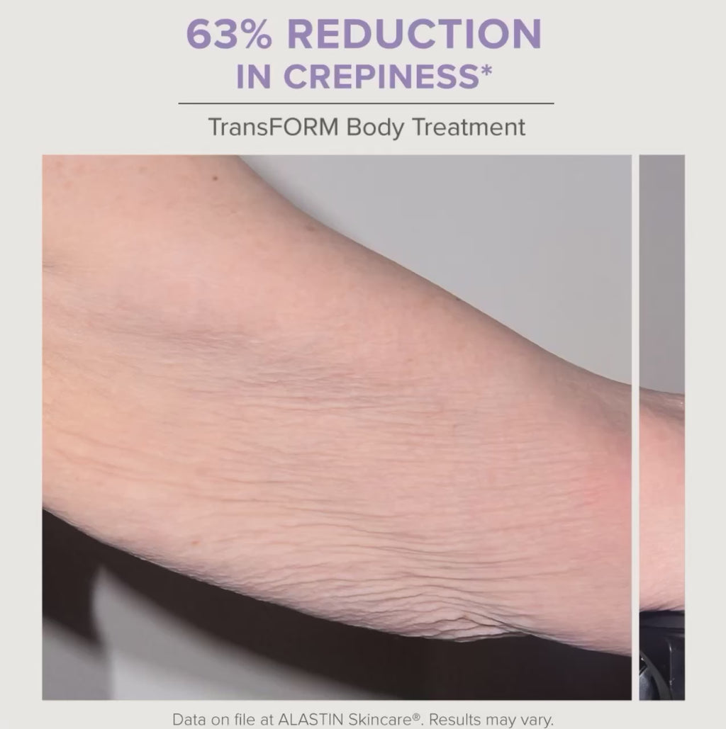 TransFORM Body Treatment with TriHex Technology®