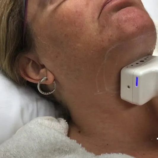 truSculpt iD- Initial Evaluation (Double Chin)